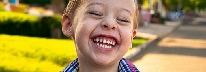 FC – Phase 1 Care: Early Orthodontic Treatment at All Smiles Orthodontics